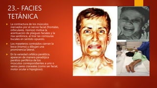 23.- FACIES
TETÁNICA
 La contractura de los músculos
inervados por el nervio facial (frontales,
orbiculares, risorios) motiva la
acentuación de pliegues faciales y la
risa sardónica, al tirar las comisuras
bucales en sentido opuesto.
 Los maseteros contraídos cierran la
boca (trismo) y dibujan una
prominencia lateral.
 En la variedad cefálica paralítica,
aparecen de manera paradójica
parálisis periférica de los
músculos correspondientes a uno o
varios pares craneales (como ser facial,
motor ocular e hipogloso).
 