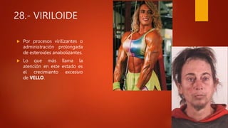 28.- VIRILOIDE
 Por procesos virilizantes o
administración prolongada
de esteroides anabolizantes.
 Lo que más llama la
atención en este estado es
el crecimiento excesivo
de VELLO.
 