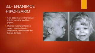 33.- ENANIMOS
HIPOFISARIO
 Cara pequeña, con mandíbula
inferior retraída (perfil de
pájaro).
 Dientes mal implantados; a
veces coexisten las dos
denticiones, formándose dos
hileras dentales.
 
