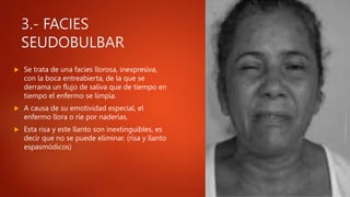 3.- FACIES
SEUDOBULBAR
 Se trata de una facies llorosa, inexpresiva,
con la boca entreabierta, de la que se
derrama un flujo de saliva que de tiempo en
tiempo el enfermo se limpia.
 A causa de su emotividad especial, el
enfermo llora o ríe por naderías.
 Esta risa y este llanto son inextinguibles, es
decir que no se puede eliminar. (risa y llanto
espasmódicos)
 
