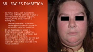 38.- FACIES DIABÉTICA
 La mímica es laxa, con placas rojizas
(rubeosis) en frente, pómulos, mejillas, y
nódulos xantomatosos en párpados,
mejillas, frente, en relación con la
hiperlipemia.
 La Rubeosis se debe a la alteración
capilar del sustrato dérmico en relación
con posibles trastornos vegetativos.
 En los diabéticos que inician el
tratamiento insulínico, se observa, a
veces, un leve edema generalizado que
borra la arrugas de la cara,
se acompaña de una palidez especial que
recuerda la porcelánica y les da una
expresión característica conocida como
"facies insulínica"
 