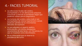 4.- FACIES TUMORAL
 Las afecciones focales del cerebro,
acompañadas o no de alteraciones psíquicas,
comunican a menudo al semblante rasgos que
podemos utilizar para el diagnóstico.
 Los tumores del cerebro, sobre todo si van
acompañados de intensa hipertensión craneal,
producen pérdida de los movimientos
delicados de expresión.
 La cara adquiere un aspecto apático,
embrutecido, y la mímica desaparece,
característica de esta facies; con frecuencia, los
ojos se muestran como desorbitados.
 No es infrecuente que se observe la
procidencia del tumor.
 