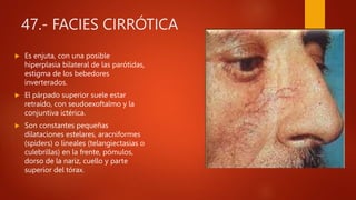 47.- FACIES CIRRÓTICA
 Es enjuta, con una posible
hiperplasia bilateral de las parótidas,
estigma de los bebedores
inverterados.
 El párpado superior suele estar
retraído, con seudoexoftalmo y la
conjuntiva ictérica.
 Son constantes pequeñas
dilataciones estelares, aracniformes
(spiders) o lineales (telangiectasias o
culebrillas) en la frente, pómulos,
dorso de la nariz, cuello y parte
superior del tórax.
 