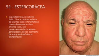 52.- ESTERCORÁCEA
 Es palidoterrosa, con aliento
fétido. Si se acostumbra abusar
de laxantes ricos en fenolftaleína
puede observarse un tinte
amarillo sucio, casi
menaodérmico (en ocasiones,
generalizado), que se acompaña
de una grave insuficiencia
pluriglandular.
 