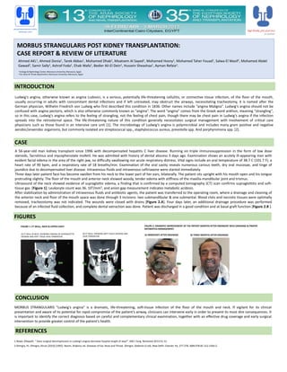 MORBUS STRANGULARIS POST KIDNEY TRANSPLANTATION:
CASE REPORT & REVIEW OF LITERATURE
Ahmed AKL1, Ahmed Donia1, Tarek Abbas1, Mohamed Dhab1, Moatsem Al Sayed1, Mohamed Hosny1, Mohamed Taher Fouad1, Salwa El Wasif1, Mohamed Abdel
Gawad2, Samir Sally1, Ashraf Foda1, Ehab Wafa1, Bedier Ali-El Dein1, Hussein Sheashaa1, Ayman Refaie1.
1 Urology & Nephrology Center, Mansoura University, Mansoura, Egypt.
2 Ear, Nose & Throat department, Mansoura University, Mansoura, Egypt
CASE
INTRODUCTION
FIGURES
CONCLUSION
Ludwig’s angina, otherwise known as angina Ludovici, is a serious, potentially life-threatening cellulitis, or connective tissue infection, of the floor of the mouth,
usually occurring in adults with concomitant dental infections and if left untreated, may obstruct the airways, necessitating tracheotomy, it is named after the
German physician, Wilhelm Friedrich von Ludwig who first described this condition in 1836. Other names include “angina Maligna”. Ludwig’s angina should not be
confused with angina pectoris, which is also otherwise commonly known as “angina”. The word “angina” comes from the Greek word ankhon, meaning “strangling”,
so in this case, Ludwig’s angina refers to the feeling of strangling, not the feeling of chest pain, though there may be chest pain in Ludwig’s angina if the infection
spreads into the retrosternal space. The life-threatening nature of this condition generally necessitates surgical management with involvement of critical care
physicians such as those found in an intensive care unit [1]. The microbiology of Ludwig’s angina is polymicrobial and includes many gram positive and negative
aerobic/anaerobic organisms, but commonly isolated are streptococcal spp., staphylococcus aureus, prevotella spp. And porphyromona spp. [2].
A 56-year-old man kidney transplant since 1996 with decompensated hepatitis C liver disease. Running on triple immunosuppression in the form of low dose
steroids, Tacrolimus and mycophenolate mofetil. He was admitted with history of dental abscess 3 days ago. Examination shows an acutely ill-appearing man with
evident facial edema in the area of the right jaw, no difficulty swallowing nor acute respiratory distress. Vital signs include an oral temperature of 38.7 C (101.7 F), a
heart rate of 90 bpm, and a respiratory rate of 18 breaths/min. Examination of the oral cavity reveals numerous carious teeth, dry oral mucosae, and tinge of
jaundice due to decompensated liver disease. Intravenous fluids and intravenous ceftriaxone were started immediately.
Three days later patient face has become swollen from his neck to the lower part of her ears, bilaterally. The patient sits upright with his mouth open and his tongue
protruding slightly. The floor of the mouth and anterior neck showed woody, tender edema with stiffness of the maxilla-mandibular joint and trismus.
Ultrasound of the neck showed evidence of supraglottic edema, a finding that is confirmed by a computed tomography (CT) scan confirms supraglottitis and soft-
tissue gas [Figure 1]. Leukocyte count was 36. 103/mm3, and anion gap measurement indicates metabolic acidosis.
After stabilization by administration of intravenous fluids and antibiotic agents, the patient was transferred to the operating room, where a drainage and cleaning of
the anterior neck and floor of the mouth space was done through 3 incisions: two submandibular & one submental. Blood clots and necrotic tissues were optimally
removed, tracheostomy was not indicated. The wounds were closed with drains [Figure 2.A]. Four days later, an additional drainage procedure was performed
because of an infected fluid collection, and complete dental extraction was done. Patient was discharged in a good condition and at basal graft function [Figure 2.B ].
MORBUS STRANGULARIS “Ludwig’s angina” is a dramatic, life-threatening, soft-tissue infection of the floor of the mouth and neck. If vigilant for its clinical
presentation and aware of its potential for rapid compromise of the patient’s airway, clinicians can intervene early in order to prevent its most dire consequences. It
is important to identify the correct diagnosis based on careful and complementary clinical examination, together with an effective drug coverage and early surgical
intervention to provide greater control of the patient’s health.
A] CT SKULL & NECK: SHOWING FINDING OF SUPRAGLOTTIC
OEDEMA AND SOFT TISSUE GASE FORMATION.
B] CT SKULL SHOWING SOFT TISSUE OEDEMA AND
GASE FORMATION.
FIGURE 2: DRAMATIC IMPROVEMENT OF THE PATIENT MONTHS AFTER EMERGENT NECK DRAINAGE & PROPER
ANTIBIOTICS MANAGEMENT.
A] IMMEDIATE AFTER DRAINAGE B] THREE MONTHS AFTER DRAINAGE
FIGURE 1: CT SKULL, NECK & UPPER CHEST
REFERENCES
UROLOGY&NEPHROLOGY CENTER
MANSOURA, EGYPT
1-Rowe, Ollapallil. “ Does surgical decompression in Ludwig’s angina decrease hospital length of stay?”. ANZ J Surg. Retrieved 2013-01-31.
2-Dhingra, PL: Dhingra, Shruti (2010) [1992]. Nasim, Shabina, ed. Diseases of Ear, Nose and Throat. Dhingra. Deeksha (5 ed). New Delhi: Elsevier. Pp. 277-278. ISBN 978-81-312-2364-2.
 