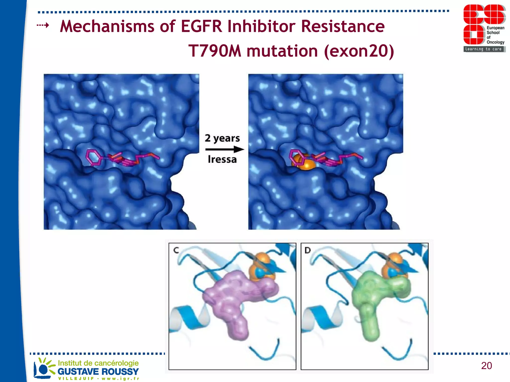 Mechanisms of EGFR Inhibitor Resistance T790M mutation (exon20) 