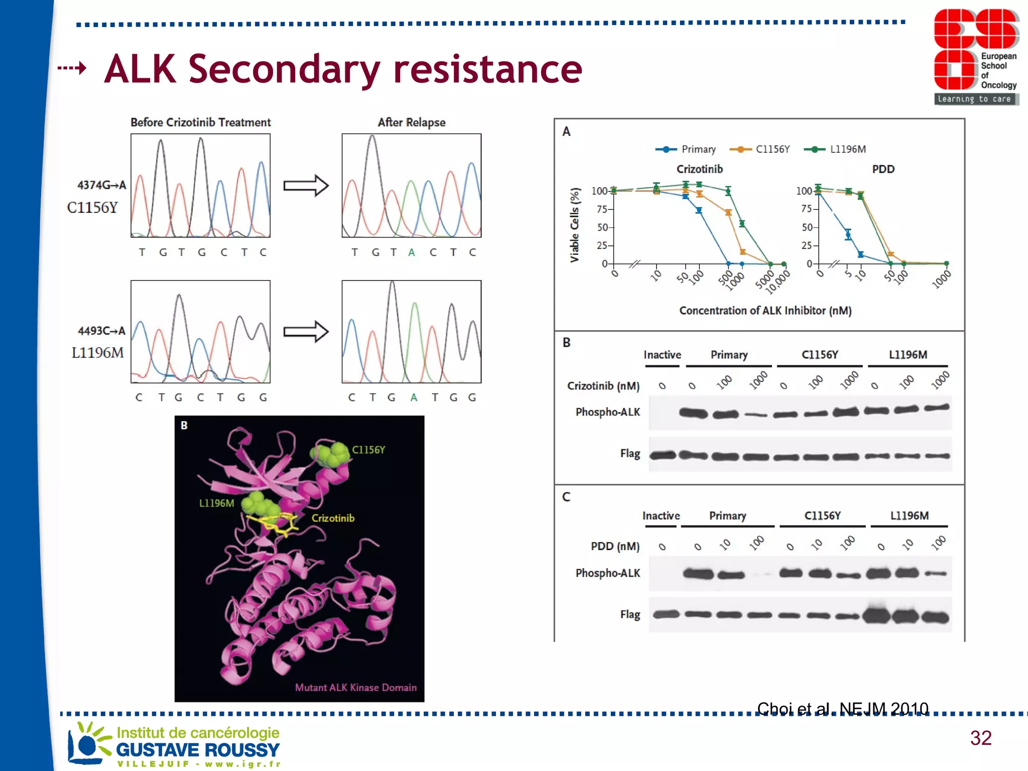 ALK Secondary resistance Choi et al. NEJM 2010 