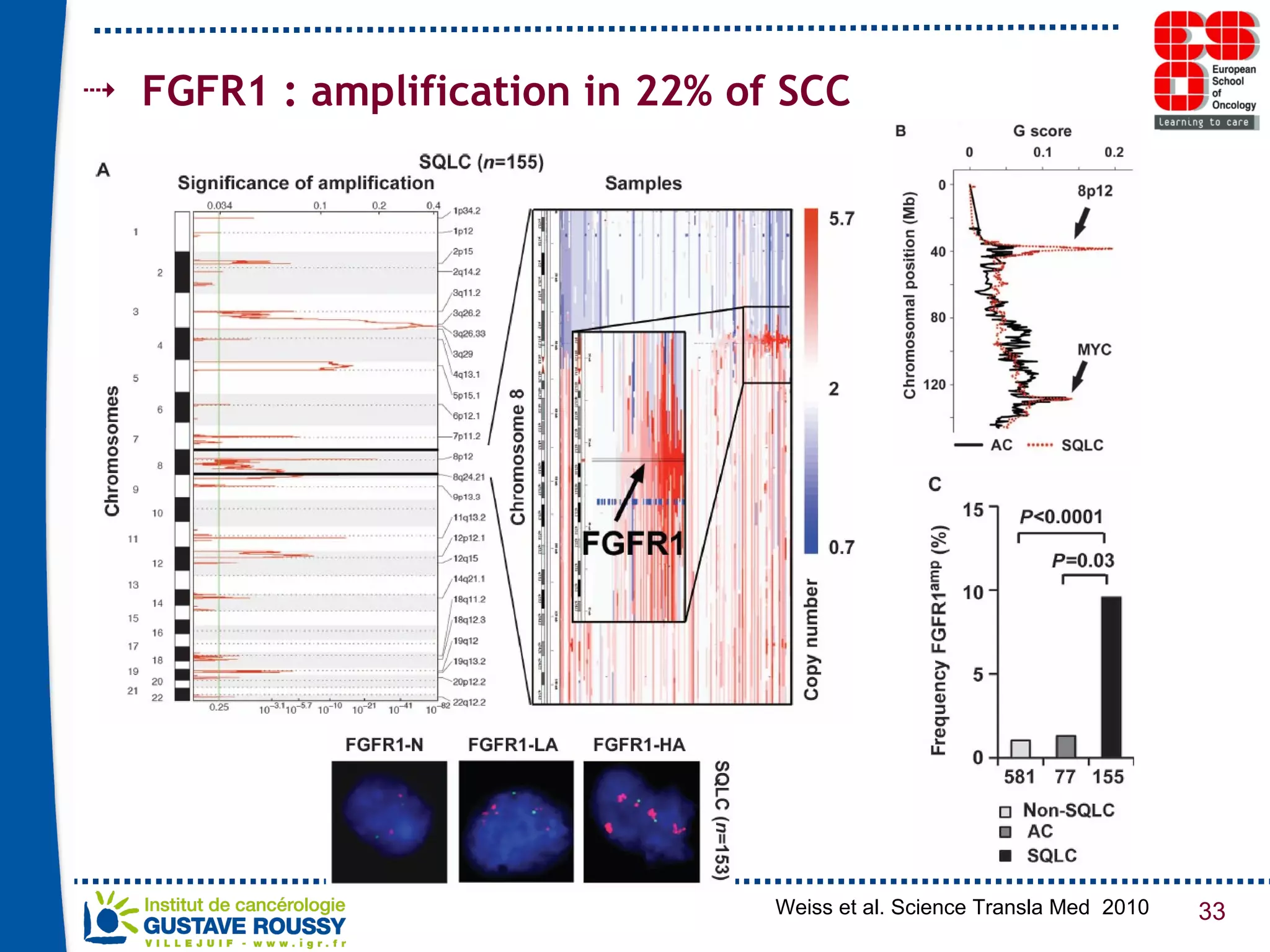 FGFR1 : amplification in 22% of SCC Weiss et al. Science Transla Med  2010 