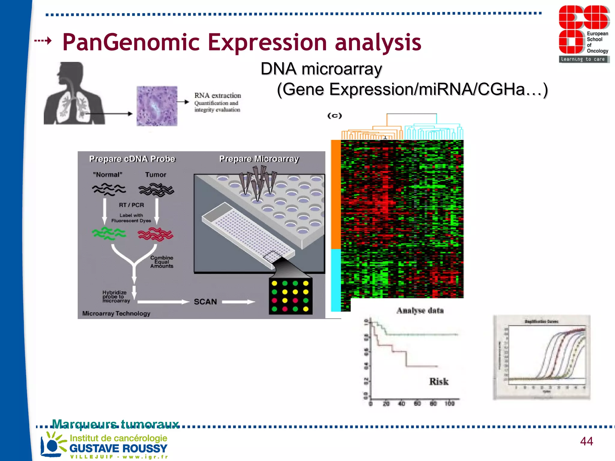 DNA microarray  (Gene Expression/miRNA/CGHa…) Marqueurs tumoraux PanGenomic Expression analysis 
