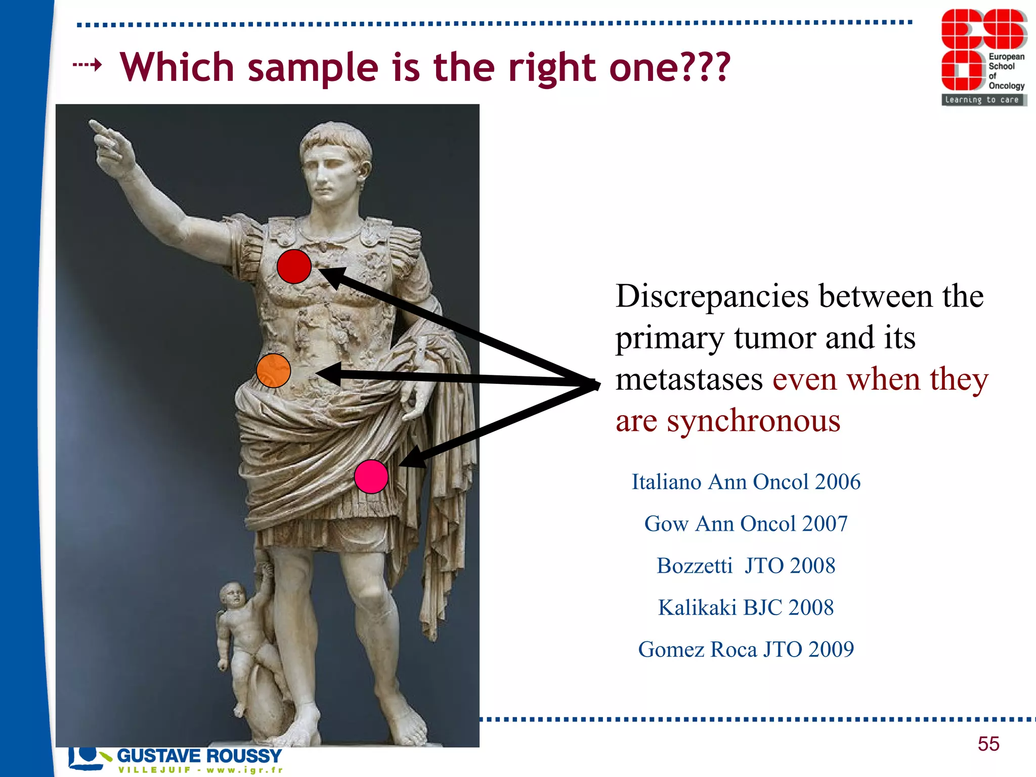 Discrepancies between the primary tumor and its metastases  even when they are synchronous Italiano Ann Oncol 2006 Gow Ann Oncol 2007 Bozzetti  JTO 2008 Kalikaki BJC 2008 Gomez Roca JTO 2009 Which sample is the right one??? 