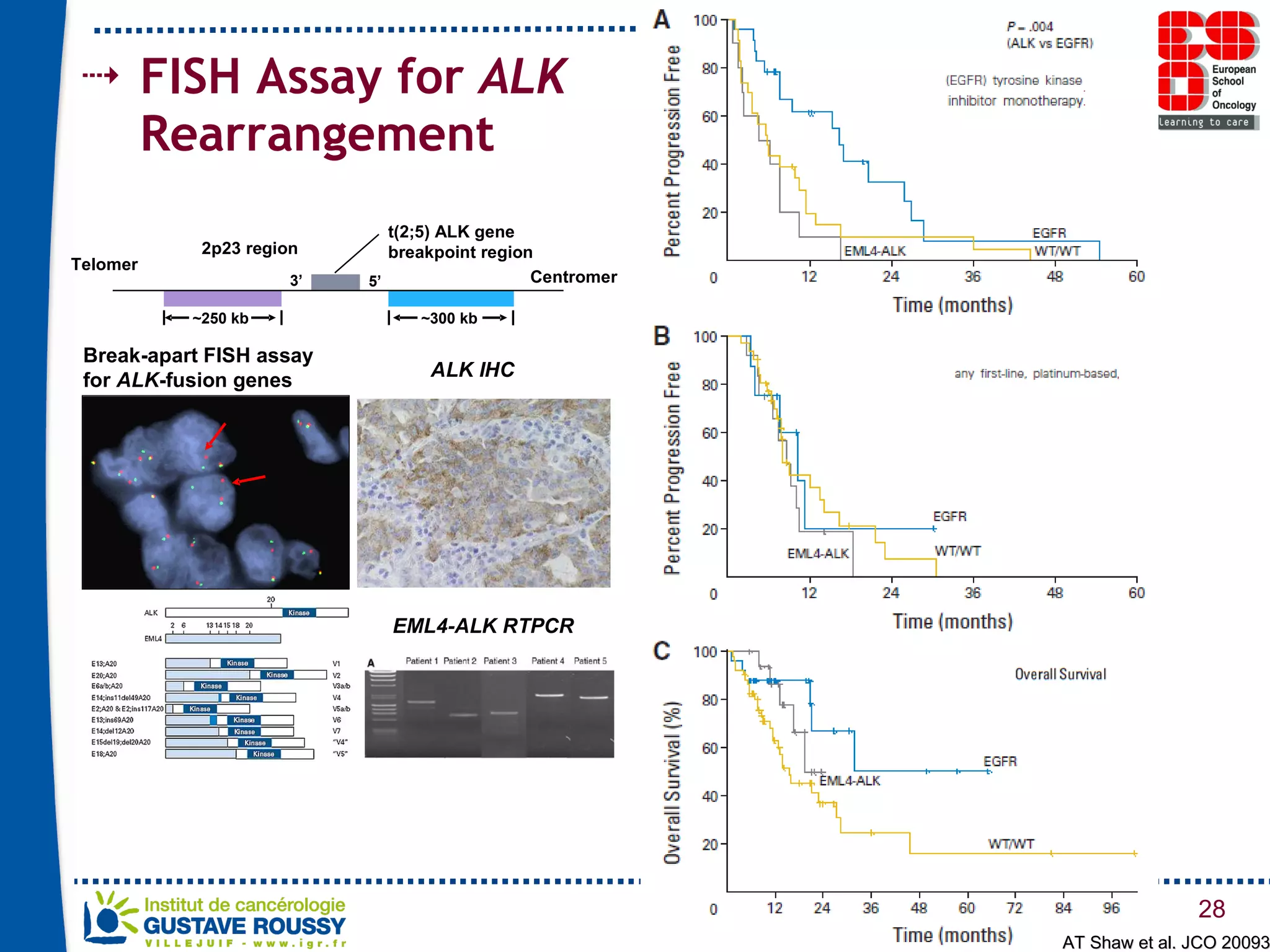 FISH Assay for  ALK  Rearrangement AT Shaw et al. JCO 20093 