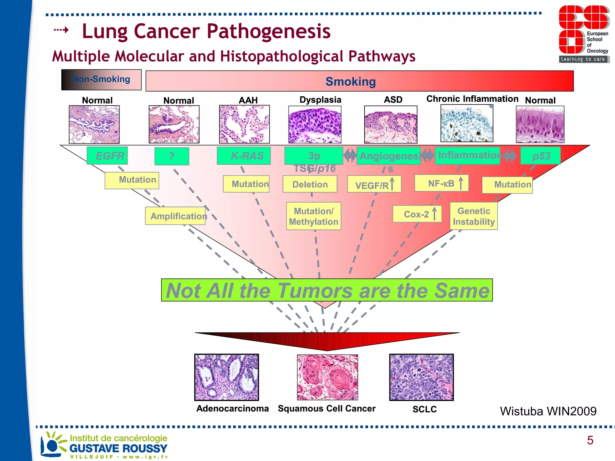 Lung Cancer Pathogenesis Multiple Molecular and Histopathological Pathways  Wistuba WIN2009 