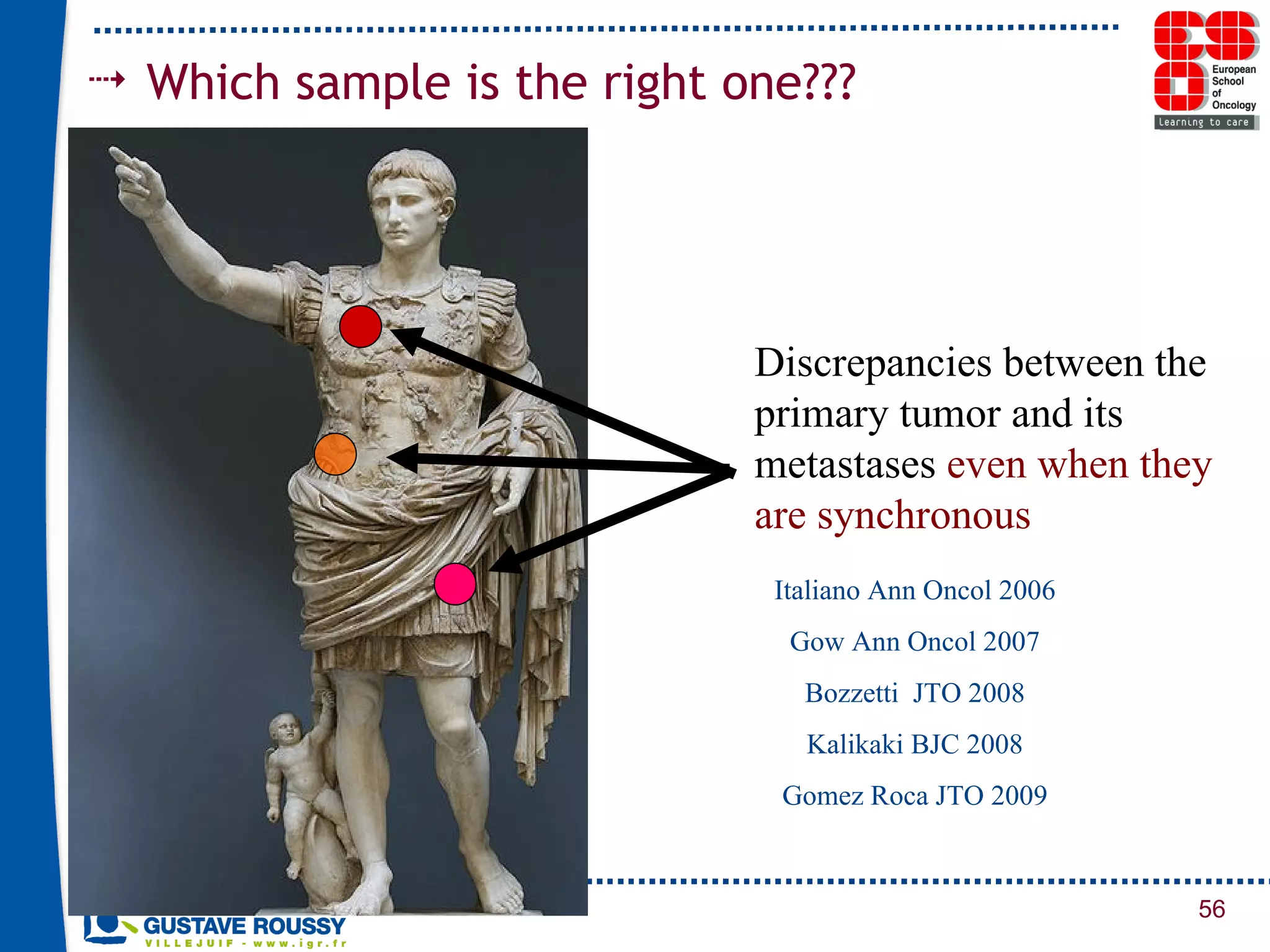 Discrepancies between the primary tumor and its metastases  even when they are synchronous Italiano Ann Oncol 2006 Gow Ann Oncol 2007 Bozzetti  JTO 2008 Kalikaki BJC 2008 Gomez Roca JTO 2009 Which sample is the right one??? 