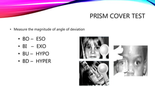 ESODEVIATION AND ITS APPROACH.pptx