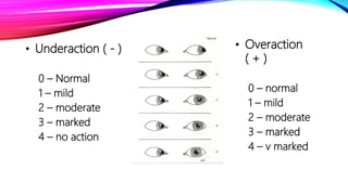 ESODEVIATION AND ITS APPROACH.pptx