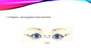 ESODEVIATION AND ITS APPROACH.pptx