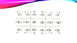 ESODEVIATION AND ITS APPROACH.pptx