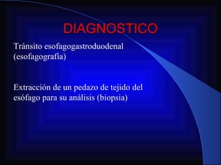 DIAGNOSTICO Tránsito esofagogastroduodenal (esofagografía) Extracción de un pedazo de tejido del esófago para su análisis (biopsia) 