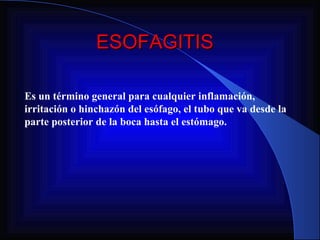 ESOFAGITIS Es un término general para cualquier inflamación, irritación o hinchazón del esófago, el tubo que va desde la parte posterior de la boca hasta el estómago. 