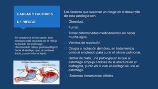 CAUSAS Y FACTORES
DE RIESGO
Los factores que suponen un riesgo en el desarrollo
de esta patología son:
 Obesidad.
 Fumar.
 Tomar determinados medicamentos sin beber
mucha agua.
 Vómitos de repetición.
 Cirugía o radiación del tórax, en tratamientos
como el empleado para curar el cáncer pulmonar.
 Hernia de hiato, una patología en la que el
estómago empuja a través de la abertura en el
diafragma, punto en el cuál el esófago se une al
estómago.
 Sistemas inmunitarios débiles.
En la mayoría de los casos, esta
patología está causada por el reflujo
de líquido del estómago
(denominado reflujo gastroesofágico)
hacia el esófago, que, al contener
ácido, puede irritar el tejido.
 