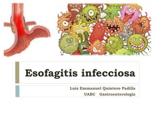 Esofagitis infecciosa
Luis Emmanuel Quintero Padilla
UABC Gastroenterología
 