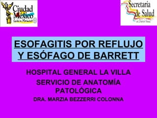 ESOFAGITIS POR REFLUJO
Y ESÓFAGO DE BARRETT
HOSPITAL GENERAL LA VILLA
SERVICIO DE ANATOMÍA
PATOLÓGICA
DRA. MARZIA BEZZERRI COLONNA
 