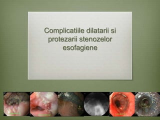 Complicatiile dilatarii si
 protezarii stenozelor
      esofagiene
 