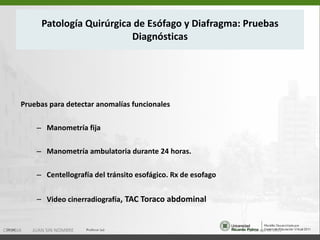 Patología Quirúrgica de Esófago y Diafragma: Pruebas Diagnósticas Pruebas para detectar anomalías funcionales Manometría fija Manometría ambulatoria durante 24 horas. Centellografía del tránsito esofágico. Rx de esofago Video cinerradiografía , TAC Toraco abdominal 15 de ago de 2011 CIRUGIA  JUAN SIN NOMBRE 
