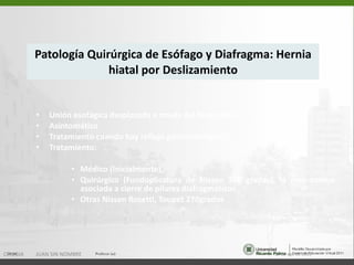 Patología Quirúrgica de Esófago y Diafragma: Hernia hiatal por Deslizamiento Unión esofágica desplazada a través del hiato (90%). Asintomático Tratamiento cuando hay reflujo gastroesofágico. Tratamiento: Médico (Inicialmente), Quirúrgico (Fundoplicatura de Nissen 360 grados), la mas comun asociada a cierre de pilares diafragmaticos Otras Nissen Rosetti, Toupet 270grados 15 de ago de 2011 CIRUGIA  JUAN SIN NOMBRE 