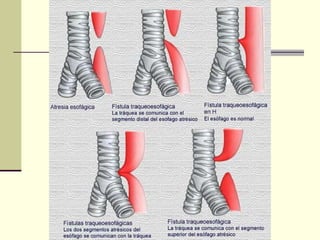 RADIOLOGIA Esofago DRA MARROQUIN | PPT