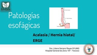 Patologías
esofágicas
▹ Acalasia / Hernia hiatal/
▹ ERGE
Dra. Liliana Serrano Reyes R1UMQ
Hospital General de Zona 197 - Texcoco
 