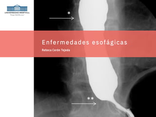Esofago - Anatomía patológica