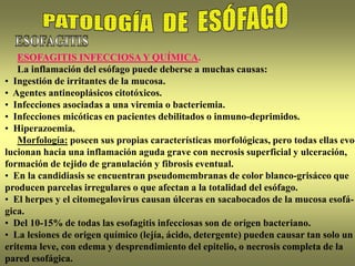 ESOFAGITIS INFECCIOSA Y QUÍMICA.
La inflamación del esófago puede deberse a muchas causas:
• Ingestión de irritantes de la mucosa.
• Agentes antineoplásicos citotóxicos.
• Infecciones asociadas a una viremia o bacteriemia.
• Infecciones micóticas en pacientes debilitados o inmuno-deprimidos.
• Hiperazoemia.
Morfología: poseen sus propias características morfológicas, pero todas ellas evo-
lucionan hacia una inflamación aguda grave con necrosis superficial y ulceración,
formación de tejido de granulación y fibrosis eventual.
• En la candidiasis se encuentran pseudomembranas de color blanco-grisáceo que
producen parcelas irregulares o que afectan a la totalidad del esófago.
• El herpes y el citomegalovirus causan úlceras en sacabocados de la mucosa esofá-
gica.
• Del 10-15% de todas las esofagitis infecciosas son de origen bacteriano.
• La lesiones de origen químico (lejía, ácido, detergente) pueden causar tan solo un
eritema leve, con edema y desprendimiento del epitelio, o necrosis completa de la
pared esofágica.
 