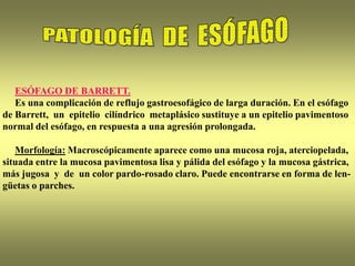 ESÓFAGO DE BARRETT.
Es una complicación de reflujo gastroesofágico de larga duración. En el esófago
de Barrett, un epitelio cilíndrico metaplásico sustituye a un epitelio pavimentoso
normal del esófago, en respuesta a una agresión prolongada.
Morfología: Macroscópicamente aparece como una mucosa roja, aterciopelada,
situada entre la mucosa pavimentosa lisa y pálida del esófago y la mucosa gástrica,
más jugosa y de un color pardo-rosado claro. Puede encontrarse en forma de len-
güetas o parches.
 