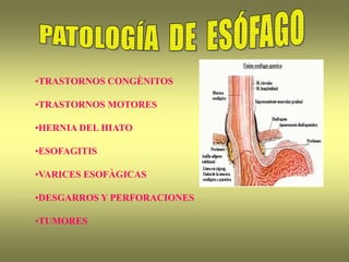 •TRASTORNOS CONGÈNITOS
•TRASTORNOS MOTORES
•HERNIA DEL HIATO
•ESOFAGITIS
•VARICES ESOFÀGICAS
•DESGARROS Y PERFORACIONES
•TUMORES
 