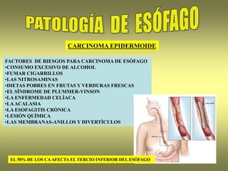 FACTORES DE RIESGOS PARA CARCINOMA DE ESÒFAGO
•CONSUMO EXCESIVO DE ALCOHOL
•FUMAR CIGARRILLOS
•LAS NITROSAMINAS
•DIETAS POBRES EN FRUTAS Y VERDURAS FRESCAS
•EL SÌNDROME DE PLUMMER-VINSON
•LA ENFERMEDAD CELÌACA
•LAACALASIA
•LA ESOFAGITIS CRÒNICA
•LESIÒN QUÌMICA
•LAS MEMBRANAS-ANILLOS Y DIVERTÌCULOS
CARCINOMA EPIDERMOIDE
EL 50% DE LOS CAAFECTA EL TERCIO INFERIOR DEL ESÒFAGO
 