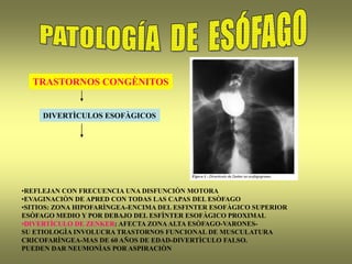 TRASTORNOS CONGÈNITOS
DIVERTÌCULOS ESOFÀGICOS
•REFLEJAN CON FRECUENCIA UNA DISFUNCIÒN MOTORA
•EVAGINACIÒN DE APRED CON TODAS LAS CAPAS DEL ESÒFAGO
•SITIOS: ZONA HIPOFARÌNGEA-ENCIMA DEL ESFINTER ESOFÀGICO SUPERIOR
ESÒFAGO MEDIO Y POR DEBAJO DEL ESFÌNTER ESOFÀGICO PROXIMAL
•DIVERTÌCULO DE ZENKER: AFECTA ZONAALTA ESÒFAGO-VARONES-
SU ETIOLOGÌA INVOLUCRA TRASTORNOS FUNCIONAL DE MUSCULATURA
CRICOFARÌNGEA-MAS DE 60 AÑOS DE EDAD-DIVERTÌCULO FALSO.
PUEDEN DAR NEUMONÌAS POR ASPIRACIÒN
 