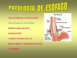 •TRASTORNOS CONGÈNITOS
•TRASTORNOS MOTORES
•HERNIA DEL HIATO
•ESOFAGITIS
•VARICES ESOFÀGICAS
•DESGARROS Y PERFORACIONES
•TUMORES
 