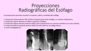 ESOFAGO.pdf GASTROINTETSINAL RX PROYECCIONES | PDF