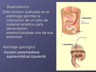 Esofago 2010 anatomia y tecnica