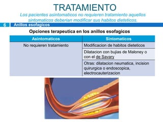 TRATAMIENTO
       Los pacientes asintomaticos no requieren tratamiento aquellos
           sintomaticos deberian modificar sus habitos dieteticos.
6   Anillos esofagicos
           Opciones terapeutica en los anillos esofagicos
             Asintomaticos                        Sintomaticos
        No requieren tratamiento      Modificacion de habitos dieteticos
                                      Dilatacion con bujias de Maloney o
                                      con el de Savary
                                      Otras: dilatacion neumatica, incision
                                      quirurgica o endoscopica,
                                      electrocauterizacion
 