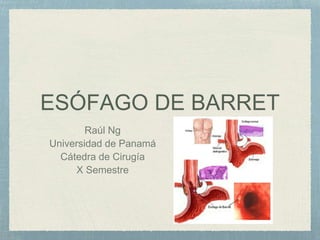 ESÓFAGO DE BARRET
Raúl Ng
Universidad de Panamá
Cátedra de Cirugía
X Semestre
 