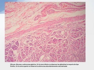 HEx100. Mucosa y submucosa gástrica. En la zona inferior se observan las glándulas la mayoría de tipo fúndico. En la zona ...