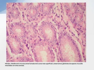 HEx600. Detalle de la mucosa antral tomado de la zona más superficial y observamos glándulas de aspecto mucoide mezcladas ...