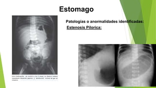 Esofago,estomago y duodeno, anatomia yusde.pptx