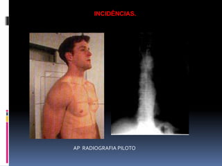 INCIDÊNCIAS.
AP RADIOGRAFIA PILOTO
 