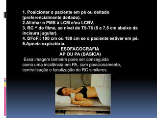 1. Posicionar o paciente em pé ou deitado
(preferencialmente deitado).
2.Alinhar o PMS à LCM e/ou LCBV.
3. RC ^ do filme, ao nível de T5-T6 (5 a 7,5 cm abaixo da
incisura jugular).
4. DFoFi: 100 cm ou 180 cm se o paciente estiver em pé.
5.Apneia expiratória.
ESOFAGOGRAFIA
AP OU PA (BÁSICA)
Essa imagem também pode ser conseguida
como uma incidência em PA, com posicionamento,
centralização e localização do RC similares.
 