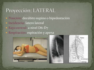  Posición: decúbito supino o bipedestación
 Incidencia: latero lateral
 Rayo central: a nivel D6-D7
 Respiración: espiración y apena
 