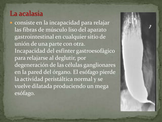 La acalasia
 consiste en la incapacidad para relajar    patologias
 las fibras de músculo liso del aparato
 gastrointestinal en cualquier sitio de
 unión de una parte con otra.
 Incapacidad del esfínter gastroesofágico
 para relajarse al deglutir, por
 degeneración de las células ganglionares
 en la pared del órgano. El esófago pierde
 la actividad peristáltica normal y se
 vuelve dilatada produciendo un mega
 esófago.
 