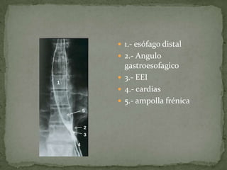  1.- esófago distal
 2.- Angulo
  gastroesofagico
 3.- EEI
 4.- cardias
 5.- ampolla frénica
 